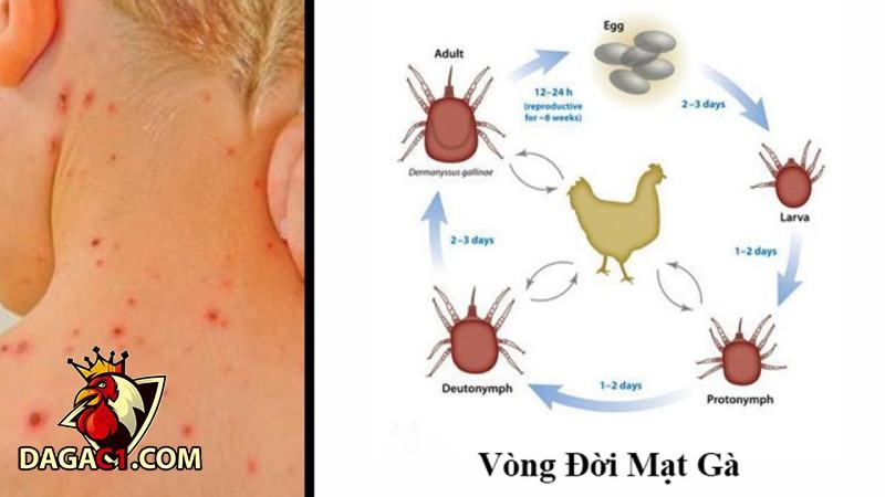 Mạt gà là gì?